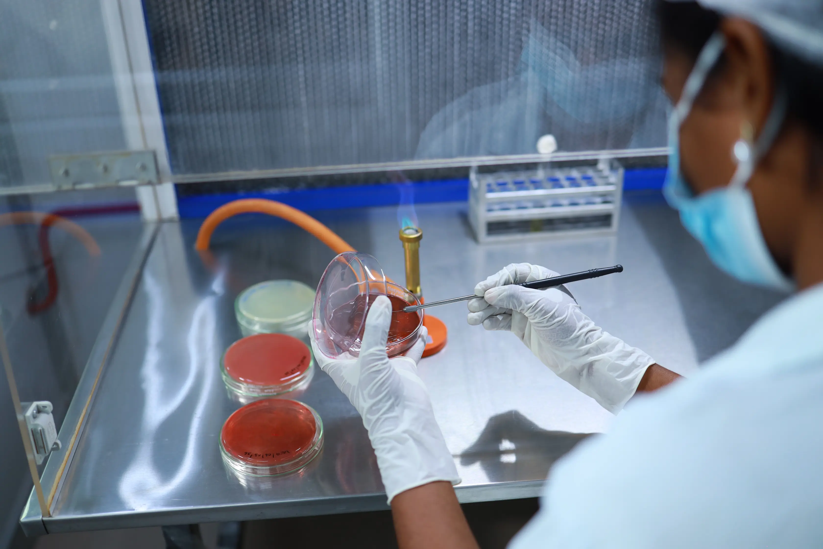 MB Lab 1